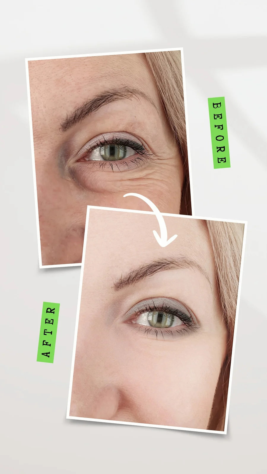 "Anti-Ageing and Skincare Made Easy And being Young only in this ebook