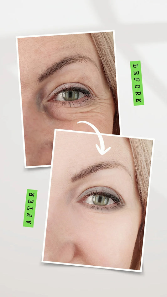 "Anti-Ageing and Skincare Made Easy And being Young only in this ebook